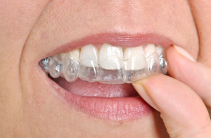 Straighten Your Teeth All About Invisalign