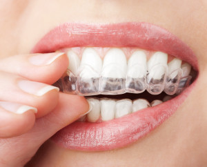 Which Cosmetic Dentistry Option is Best for You